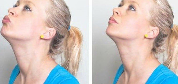 5 Exercises For A Defined Jawline