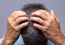 5 expert-approved ways for getting rid of dandruff in winter 5 expert-approved ways for getting rid of dandruff in winter