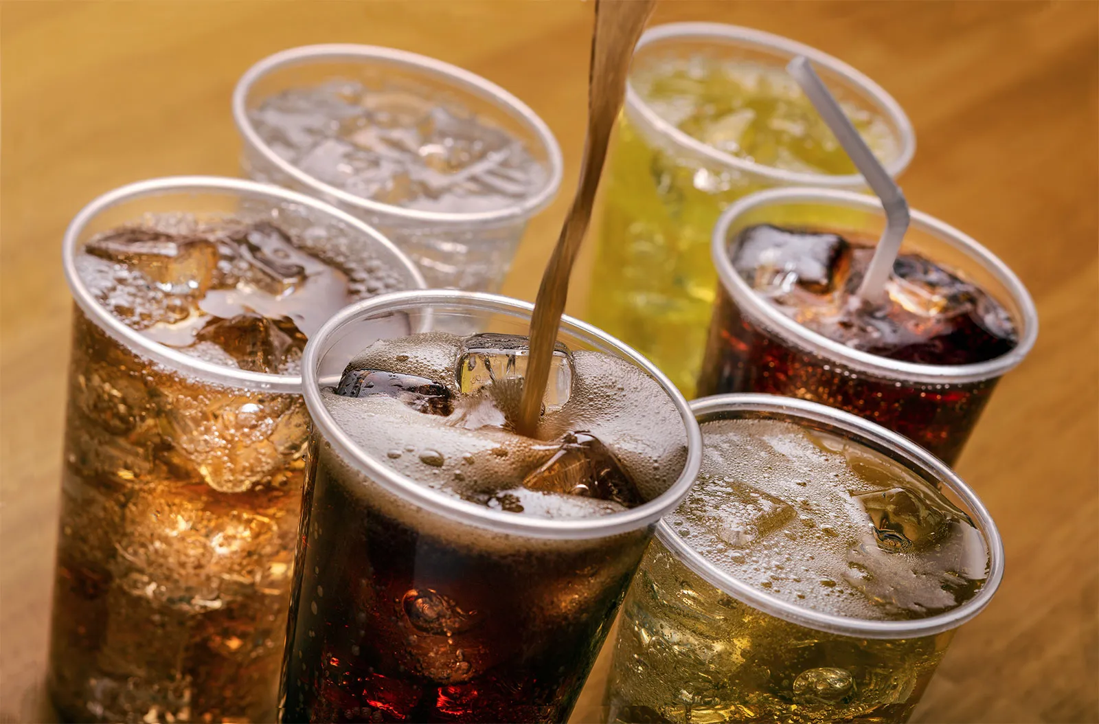 Drinks with added sugars may increase the risk of male hair loss, according to a new study